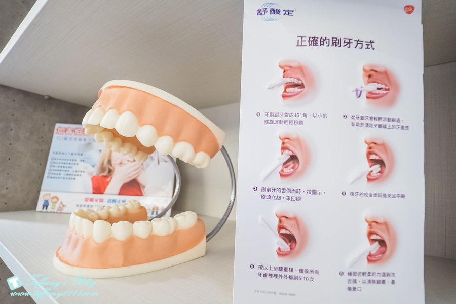 [台北牙醫診所推薦]悅庭牙醫診所/當天擁有全瓷冠美齒/還有導引式植牙提高成功率讓妳安心又放心
