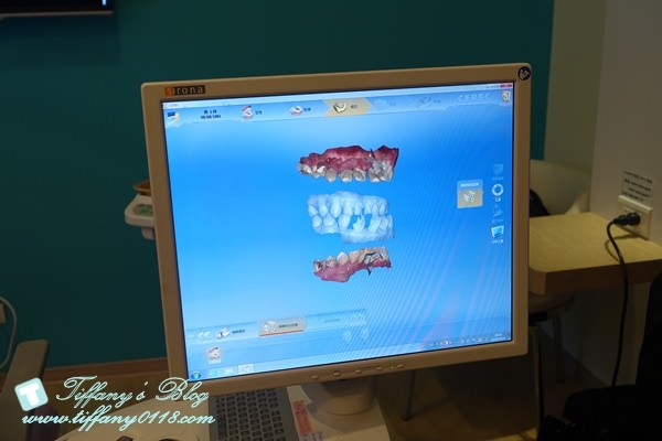 [台北牙醫診所推薦]悅庭牙醫診所讓你從此不再害怕看牙醫。一部電影的時間就讓妳擁有一口好牙!!